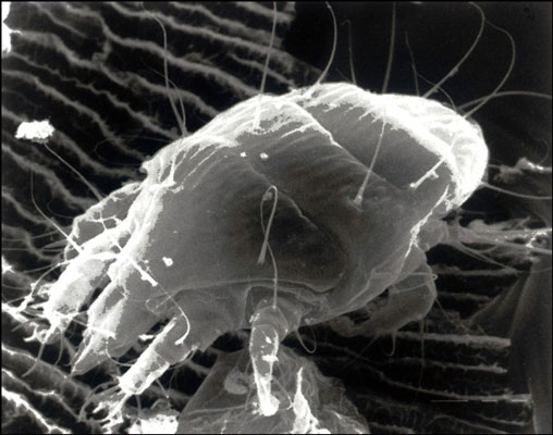 An adult tracheal mite (<i>Acarapis woodi</i>).