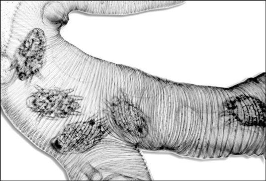 Tracheal mites (seen in this magnified photo of an infected bee’s tracheal tubes) are respons