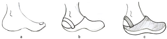 Featured image of post How To Draw Sandals On Feet In this case the feet will yet again be flat along the