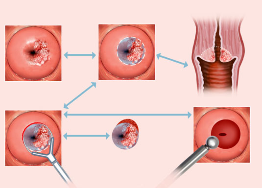 Exposure to particular infectious diseases has also been shown to be a highly relevant risk factor for certain malignant conditions.