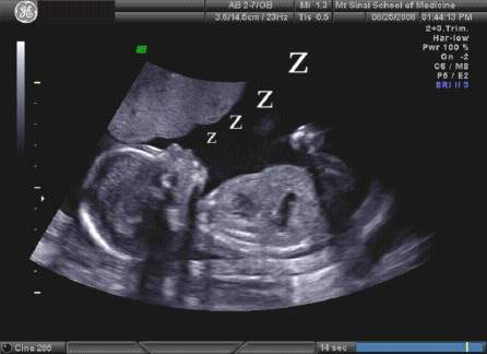 The fetal profile