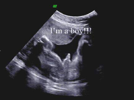 It’s a boy!