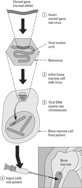 Gene therapy in humans.