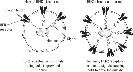 breast-HER2