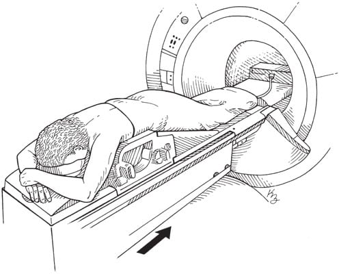 breast-mri