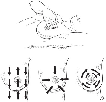 breast-patterns