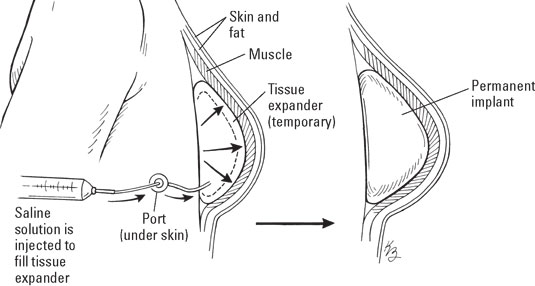 breast-tissue