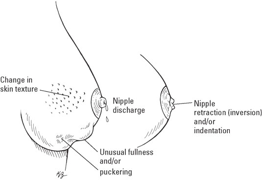 breast-visual