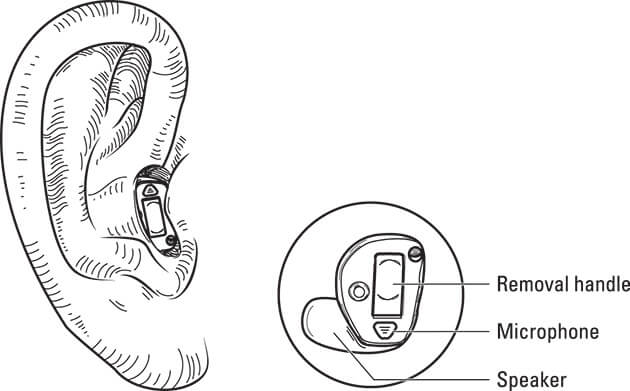 Figure showing a completely-in-the-canal hearing aid