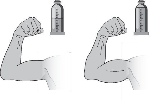 diabetes-muscle-glucose