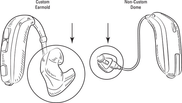 Illustration showing earmold hearing aids versus dome style