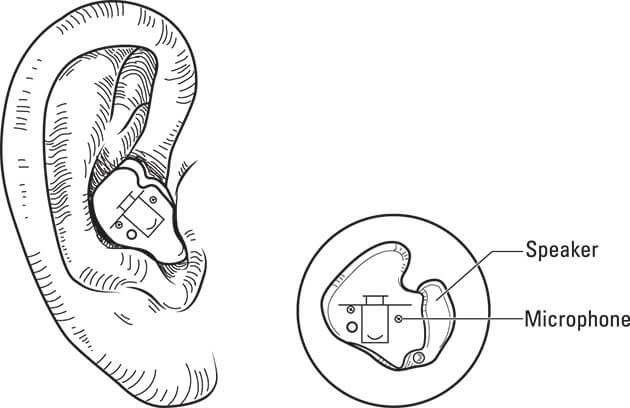 Figure showing an in-the-ear hearing aid