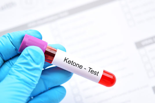 blood testing for ketosis