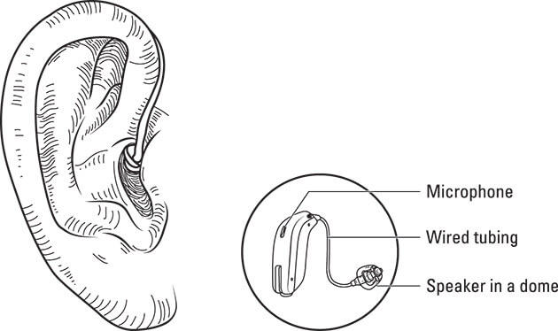 Figure showing a receiver-in-canal style hearing aid