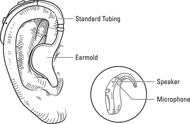 Figure showing a traditional behind-the-ear hearing aid
